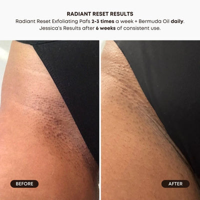 Radiant Reset Exfoliating Toner Pads